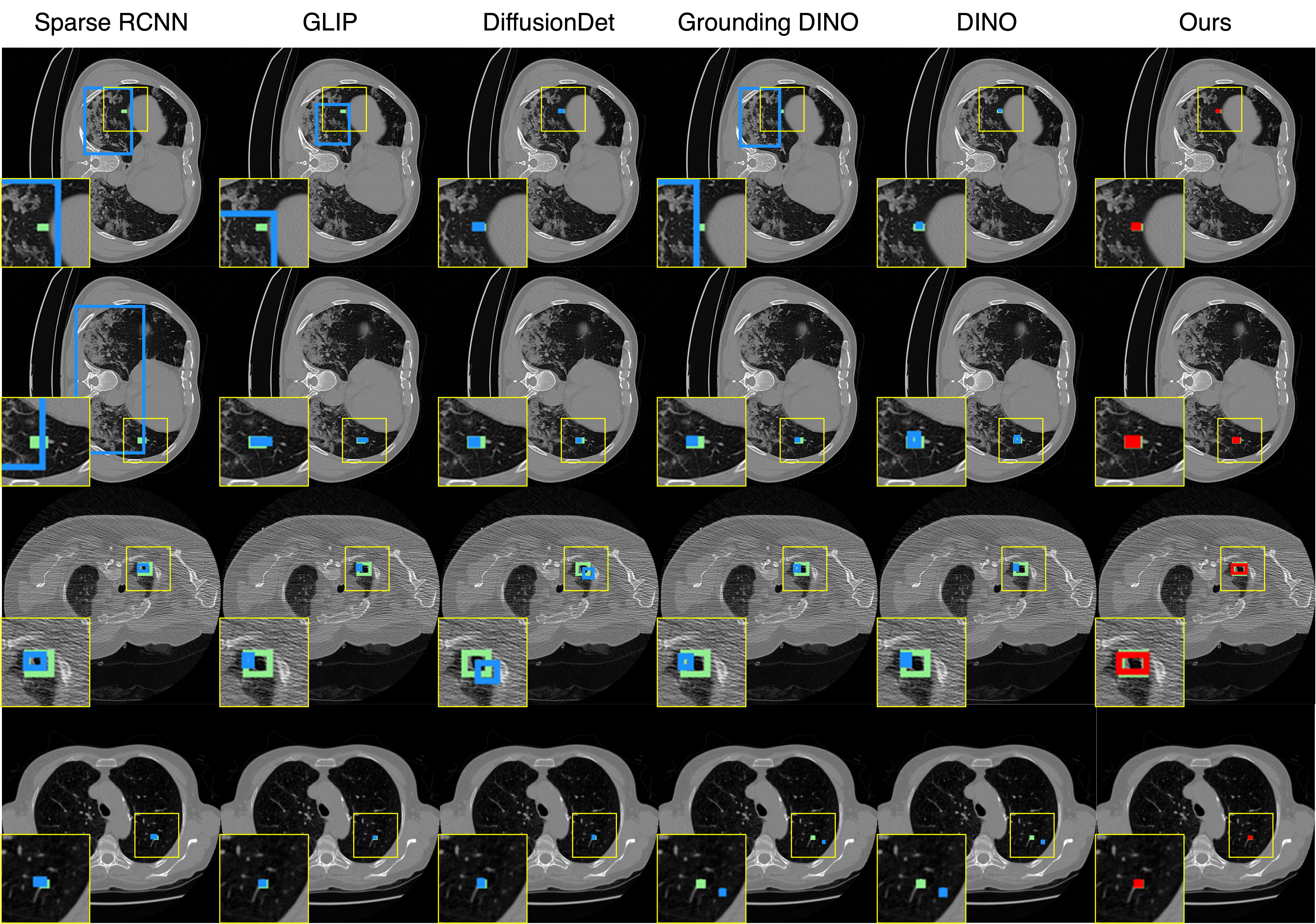 CT qualitative results