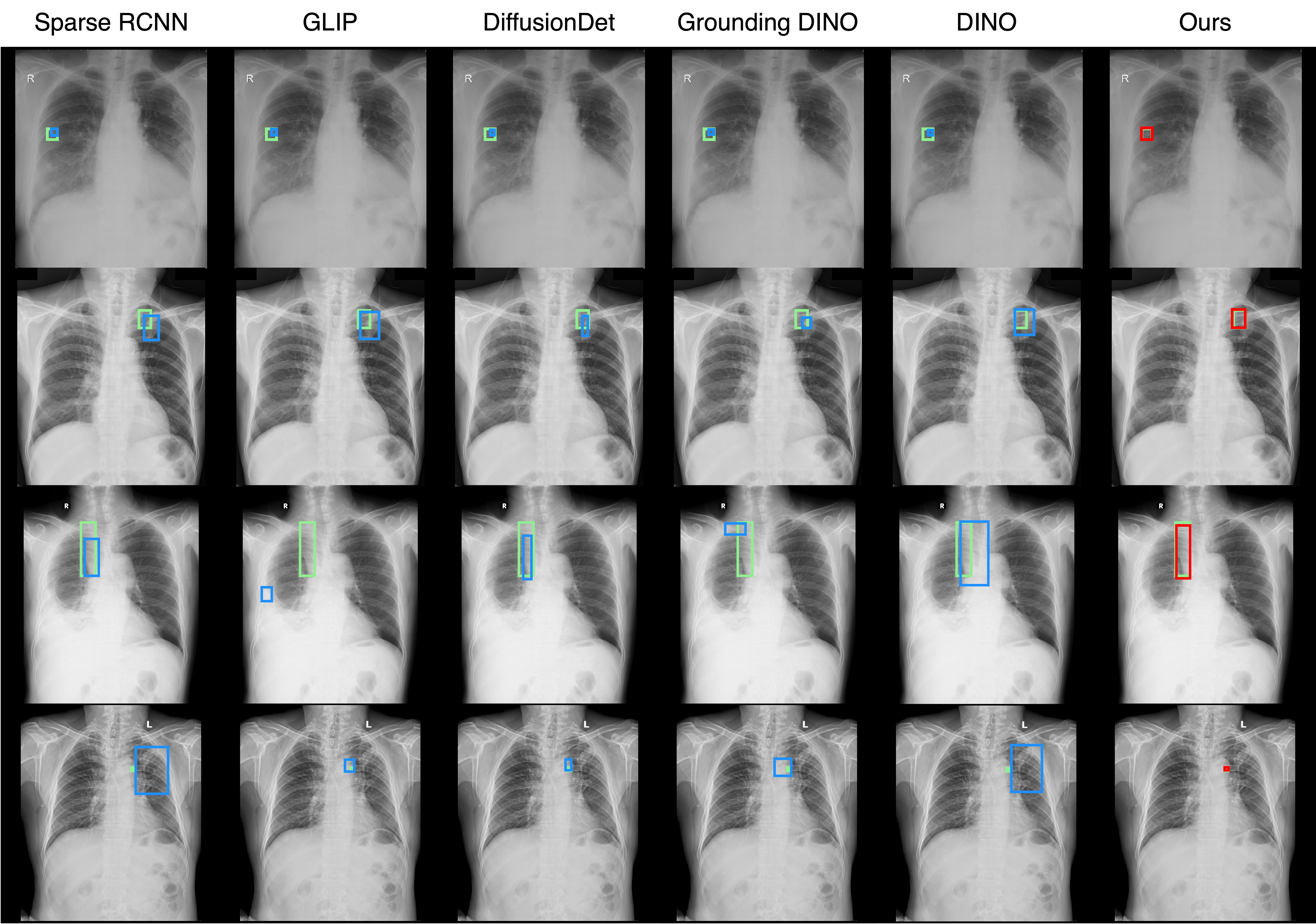 CXR qualitative results