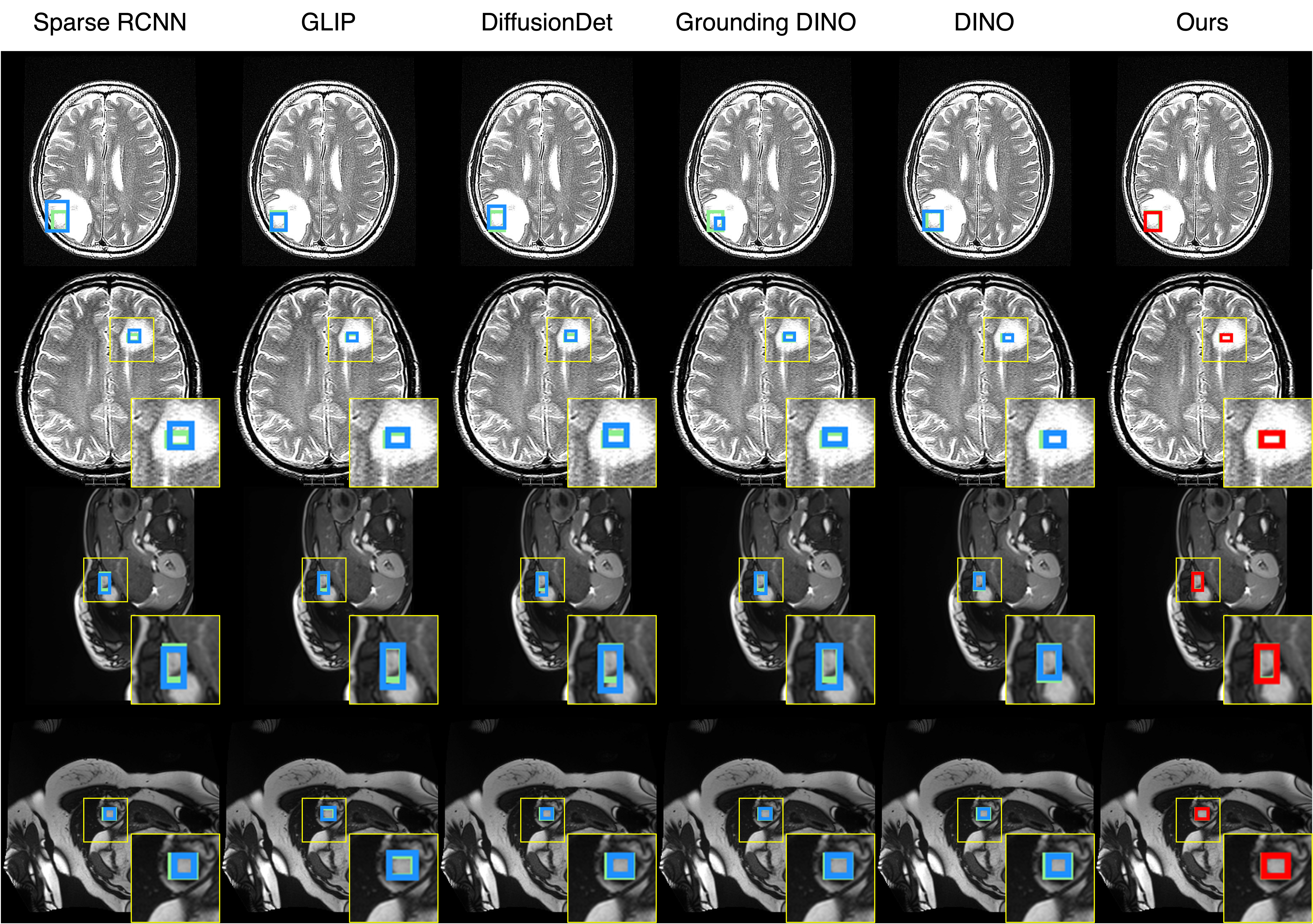MRI qualitative results
